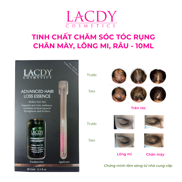 Tinh chất chăm sóc tóc rụng, chân mày, lông mi, râu - ADVANCED HAIR LOSS ESSENSE (10ml) 
