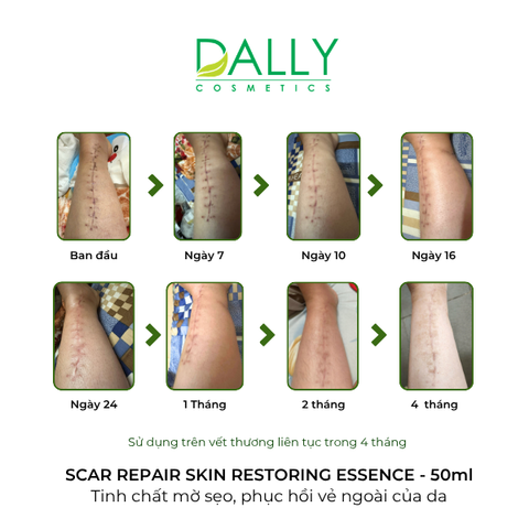  D137 SCAR REPAIR SKIN RESTORING ESSENCE - 50ml - Tinh chất hổ trợ mờ sẹo sáng da 