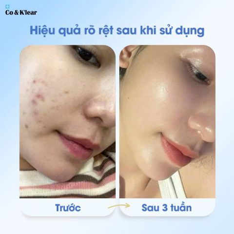  Kem Dưỡng Bakuchiol 2% CoK’lear 