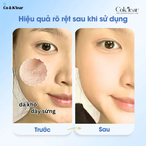  Mặt nạ Cok’lear Kombucha B5 HA Phục hồi & Cấp ẩm sâu 