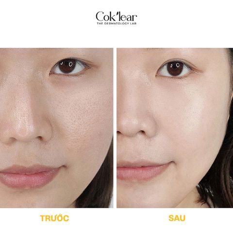  Mặt nạ Cok’lear PDRN Kombucha Brightening Mask cấp ẩm , Hỗ trợ trắng da , chống lão hóa 