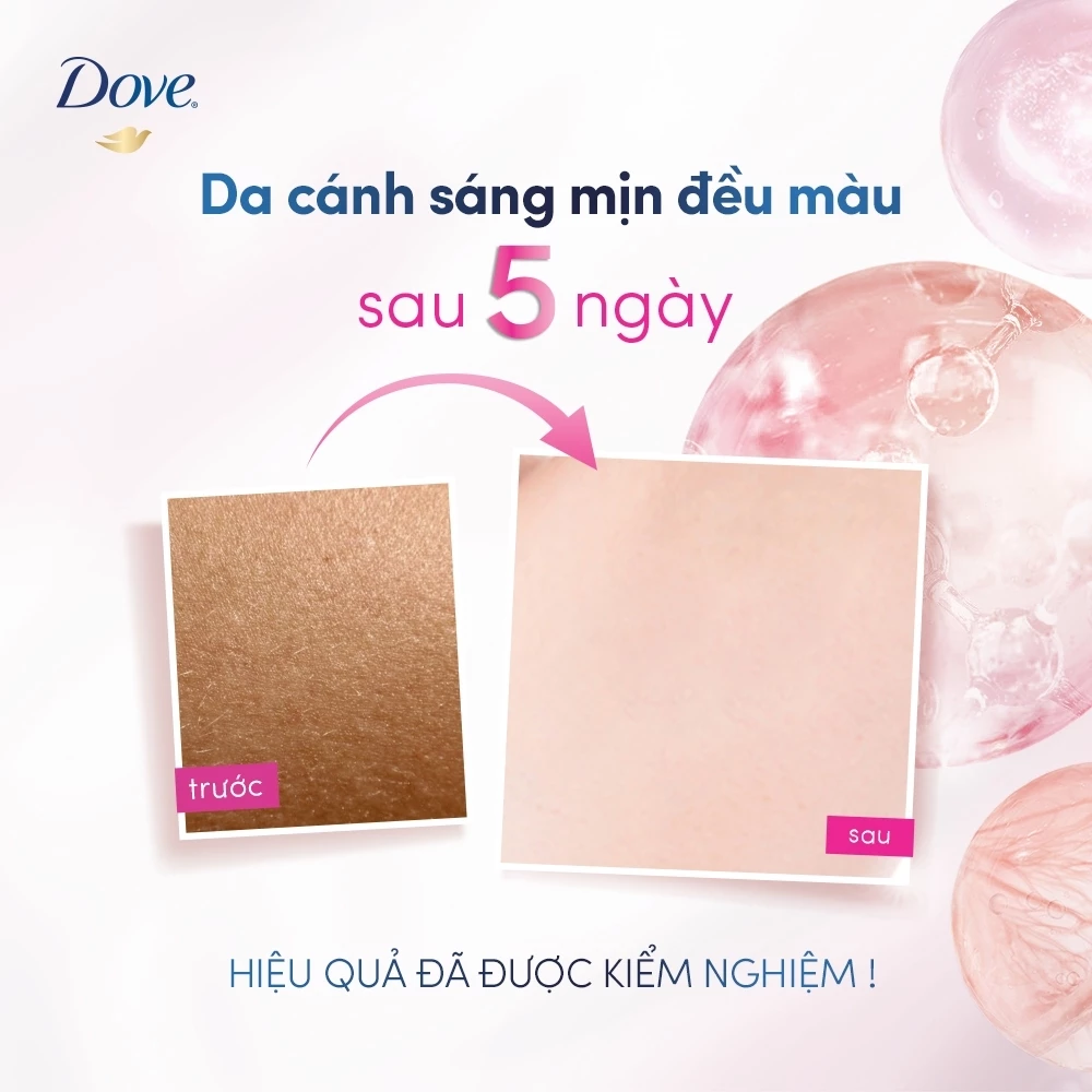  Lăn Ngăn Mùi Tinh Chất Serum, Thu Nhỏ Lỗ Chân Lông Dove Deodorant Serum 3% Niacinamide + 10X Vit C&E 45ml 