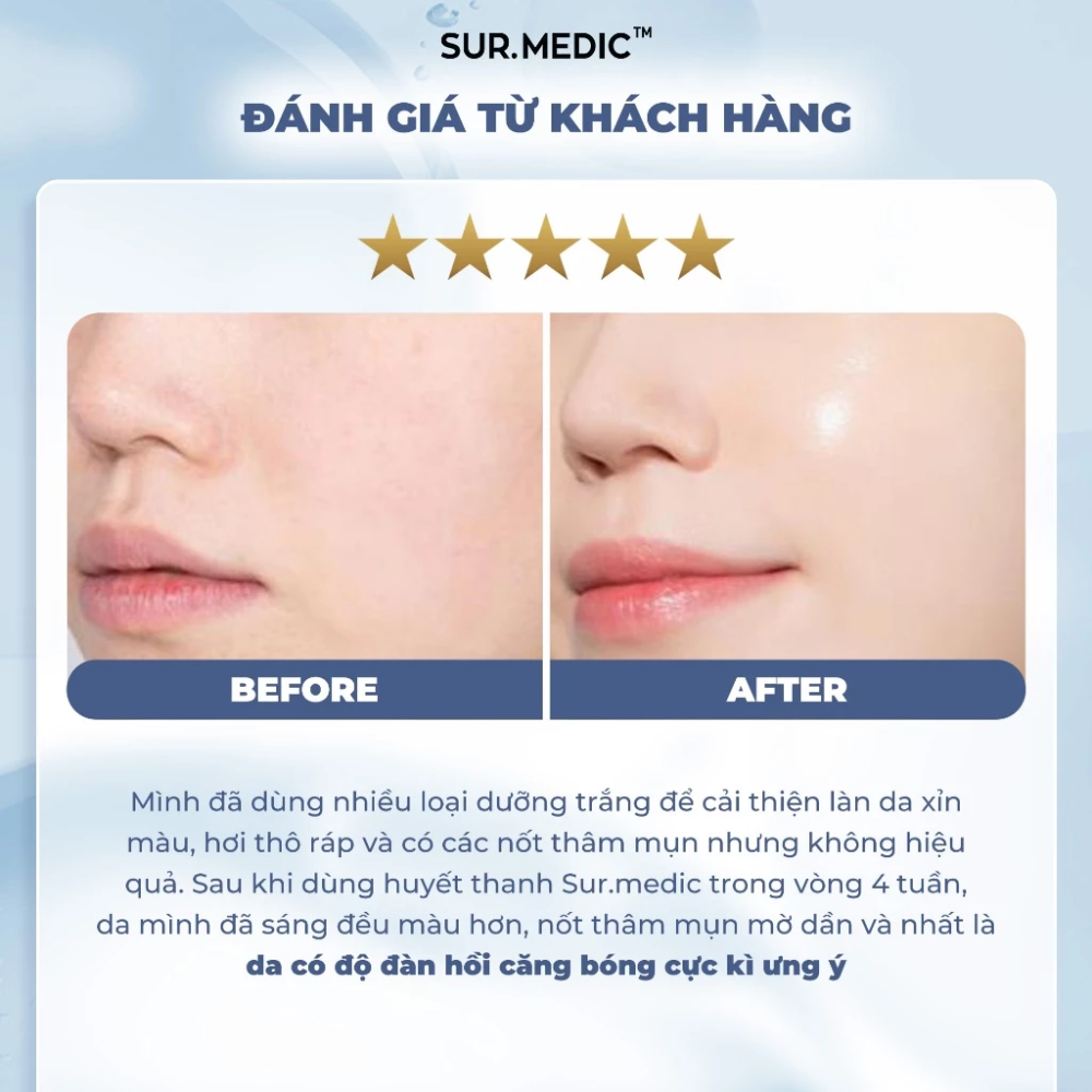  Kem Dưỡng Dưỡng Sáng, Căng Bóng Da Sur.Medic+ Super Glutathione Enriched Cream 50ml 