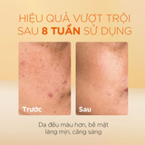  Tinh Chất Dưỡng Sáng Da, Mờ Thâm oh!oh! Daily Nia23 Advanced Correcting Serum 30ml 
