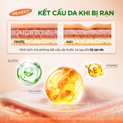Kem rạn da ngăn ngừa và hỗ trợ làm mờ vết rạn cho mẹ bầu giữa thai kỳ Palmer's