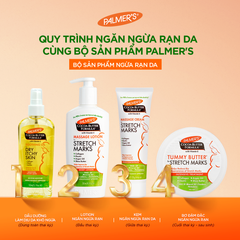 Kem rạn da ngăn ngừa và hỗ trợ làm mờ vết rạn cho mẹ bầu giữa thai kỳ Palmer's