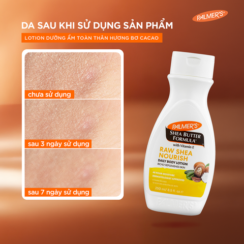Sữa dưỡng ẩm toàn thân hỗ trợ làm mềm mịn da hương Bơ Hạt Mỡ Palmer's 250ml