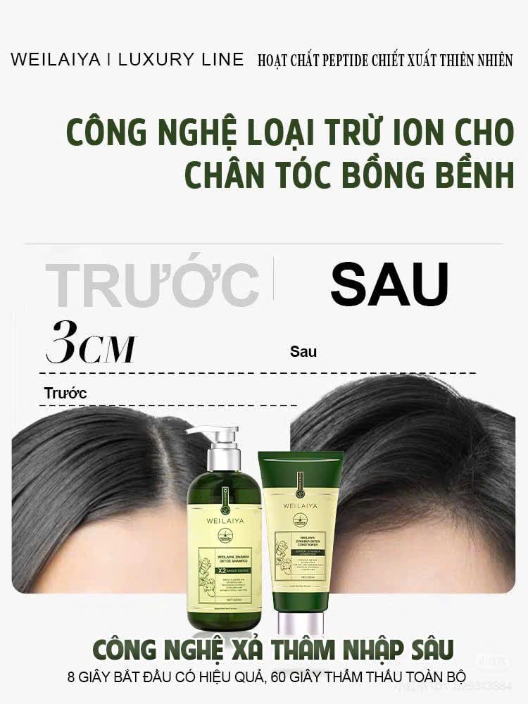 Dầu Gội Weilaiya Luxury Zingiber Detox Shampoo Chai 420ml