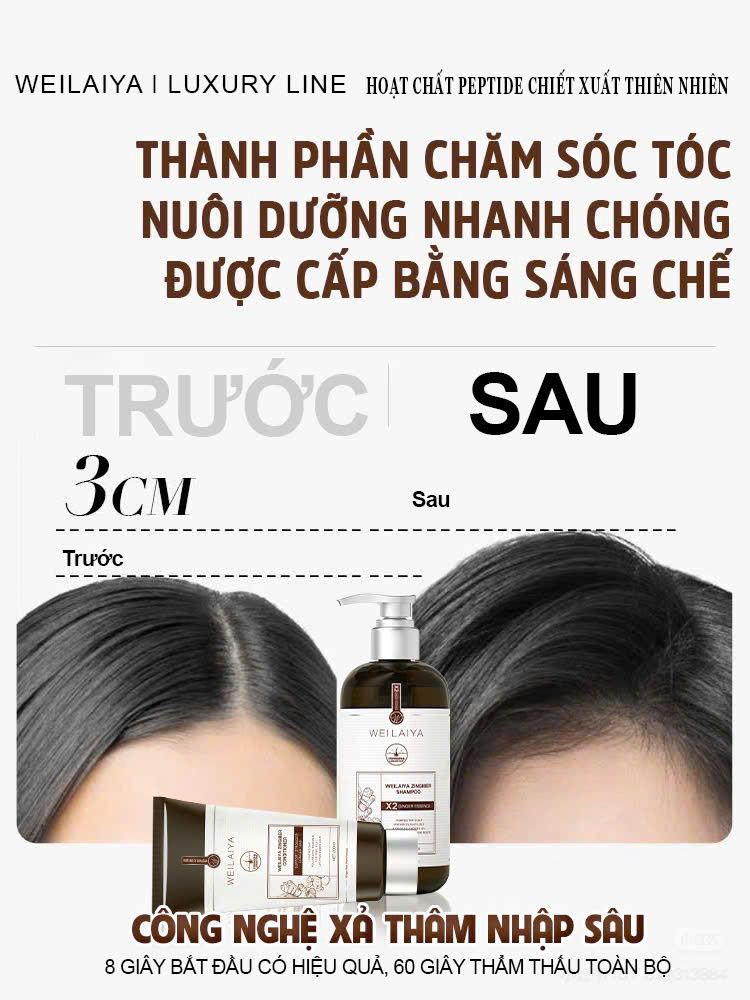 Dầu Gội Gừng Thảo Mộc Weilaiya Luxury Chai 420ml