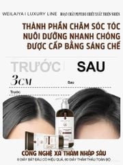 Dầu Gội Gừng Thảo Mộc Weilaiya Luxury Chai 420ml