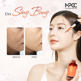  Tinh Chất Sáng Da, Giảm Nám & Tàn Nhang Mirum 50ml – Mirum Vita C.Complex Ampoule 