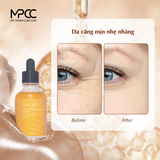  Tinh Chất Tái Tạo, Dưỡng Ẩm,Chống Nhăn & Tăng Sự Đàn Hồi Cho Da Mirum 50ml - Mirum Wrinkle Pepta Lifting Shot Ampoule 