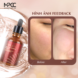  Tinh chất hồng sâm chống lão hóa, làm trắng, giữ ẩm & trẻ hóa làn da Mirum 50ml – Mirum Aging Red Ginseng Ampoule 