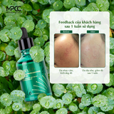  Tinh chất làm dịu, cấp ẩm, giảm mụn, giảm viêm Mirum 50ml – Mirum Calming Madecassoside Ampoule 