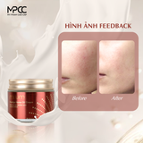  Kem dầu ngựa Mirum 70ml - Kem chống lão hóa, trắng da và giữ ẩm mirum - Mirum Prestige Horse Oil Cream 