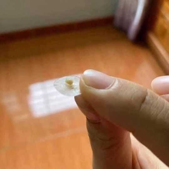 Dán mụn Cosrx Clear fit Đen