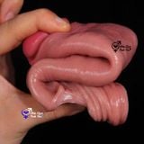  Bao cao su đôn dên tăng kích thước dương vật size nhỏ m1 