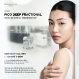  Liệu trình Laser Pico DeepFrac 
