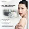  Liệu trình Laser Pico DeepFrac 