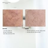  Liệu trình Laser Cool Peel 