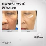  Liệu trình Láb Young Eyes 