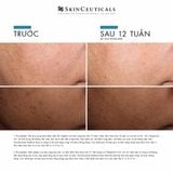  Discoloration Defense 