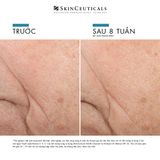  Triple Lipid Restore 2 4 2 