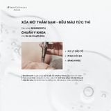  Liệu trình SkinSmooth 