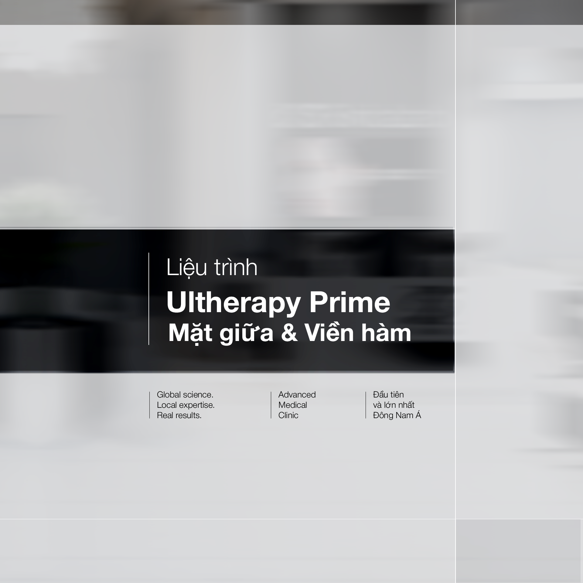  Liệu trình Ultherapy Prime - Mặt giữa & Viền hàm 
