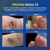 Gel băng vết thương hở LAVIOR Diabetic Hydrogel Wound Dressing 30ml