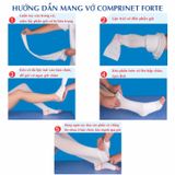  Vớ Sau Phẫu Thuật Tĩnh Mạch Comprinet Forte - Vớ Đùi, Màu Trắng, Áp Lực Cao 35mmHg 