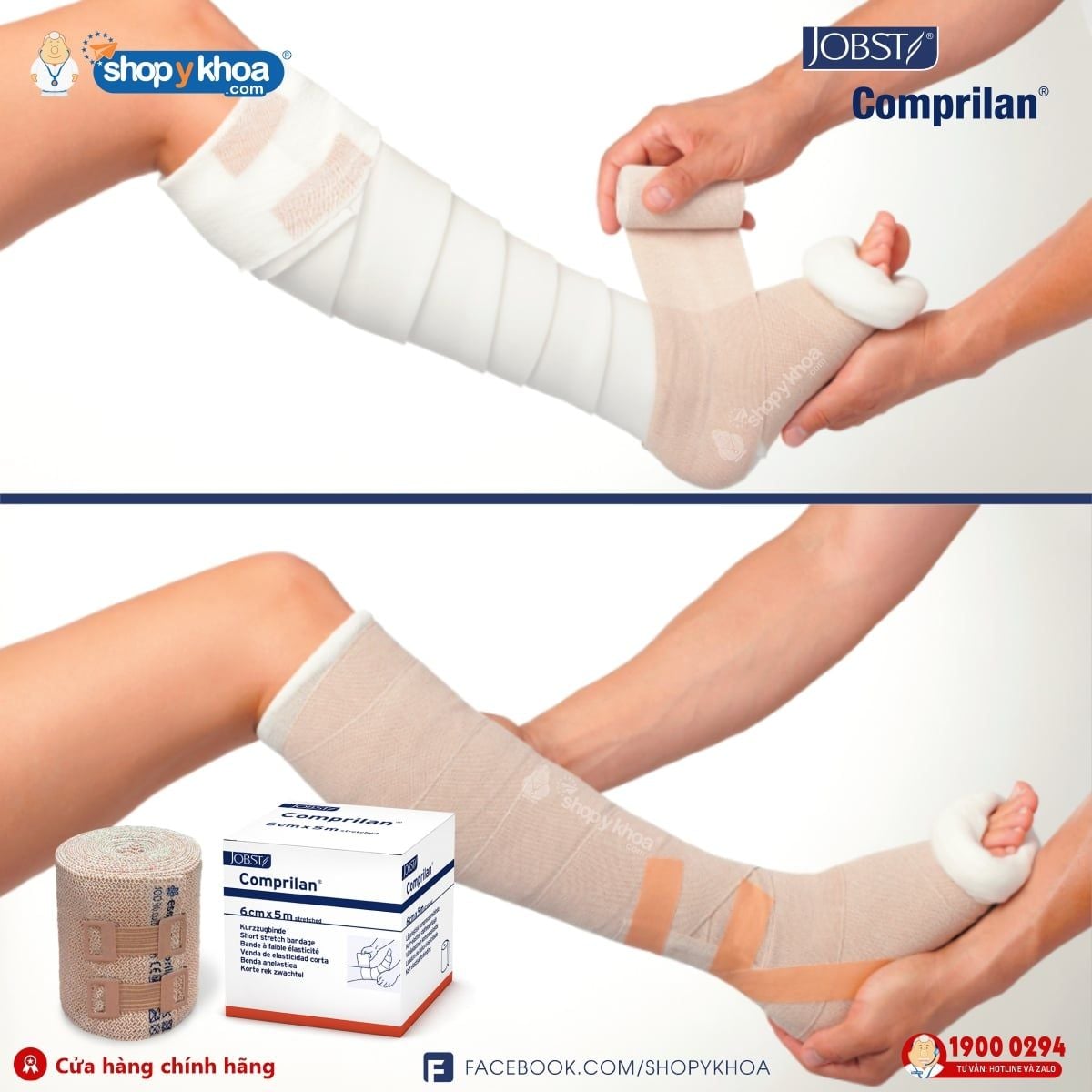  Băng gạc y tế ngoài da COMPRILAN. Băng quấn phù bạch huyết lớp 3, dạng cuộn, màu da, 6cmx5m. 