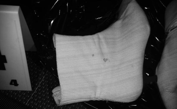 Crime-lite® AUTO - Giải pháp chụp ảnh toàn phổ thông minh cho giám định pháp y hiện đại