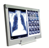  Hộp đèn đọc phim X-Ray Viewing Boxes 