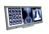 Hộp đèn đọc phim X-Ray Viewing Boxes 
