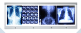  Hộp đèn đọc phim X-Ray Viewing Boxes 