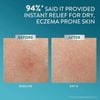 Kem làm dịu và phục hồi dành cho da khô, ngứa Cetaphil Pro AD Derma Repair Cream 226g