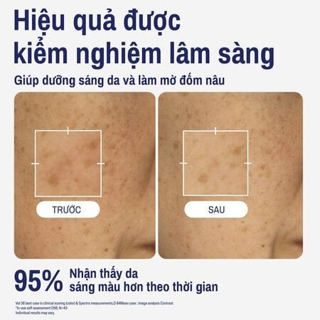 Tinh chất dưỡng sáng da và làm mờ đốm nâu Cetaphil Bright Healthy Radiance Perfecting Serum 30ml