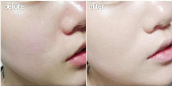 Nước Thần Sum37 Secret Essence Advanced Fullsize 80ml