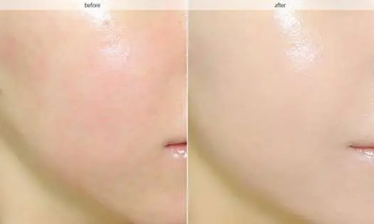 Phấn nước tinh chất vàng 24K Ohui The First Geniture Ampoule Cover Cushion