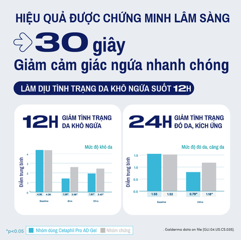 Gel Làm Dịu Và Hỗ Trợ Giảm Ngứa Cho Da Chàm, Viêm Da Cơ Địa  Cetaphil Pro AD Instant Relief & Moisturising Gel 59ml