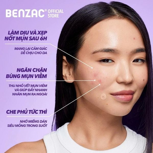 Miếng dán mụn 3 trong 1 BENZAC Power Patch x 12 miếng với Salicylic Acid