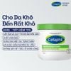 Kem dưỡng ẩm dành cho da khô đến rất khô và kể cả da nhạy cảm Cetaphil Moisturising Cream