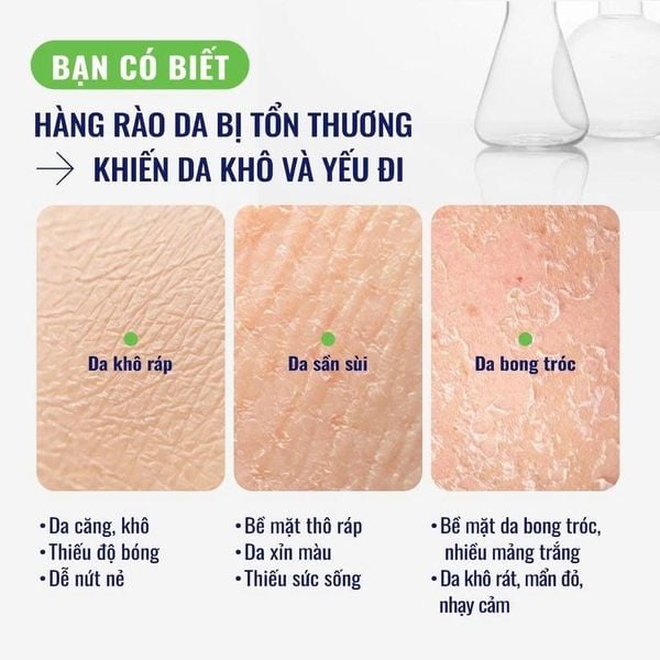Sữa dưỡng ẩm phục hồi chuyên sâu cho da khô ráp, bong tróc, nhạy cảm Cetaphil Ceramide Repair Lotion