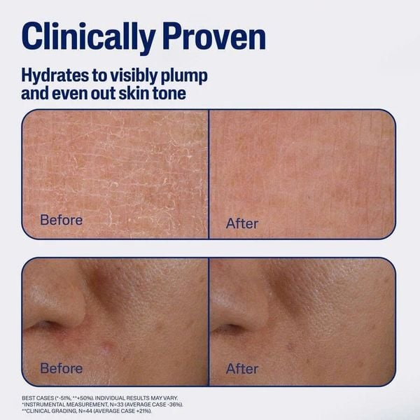 Tinh Chất Phục Hồi & Mờ Nếp Nhăn Dưỡng Da Chuyên Sâu Ban Đêm CETAPHIL REPAIR & RENEW SERUM 30ML