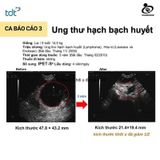  IPET S hộp 60 viên - Thực phẩm hỗ trợ Tăng Cường Miễn Dịch Cho Chó Mèo chiết xuất Taheebo 