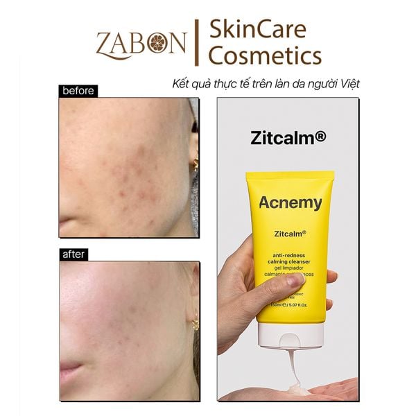 Gel rửa mặt Acnemy Zitcalm Anti-Redness Calming Cleanser giảm đỏ và làm dịu da 150ml
