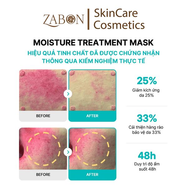Mặt nạ REJURAN MOISTURE TREATMENT MASK dưỡng ẩm, làm dịu hỗ trợ phục hồi 23ml (1 miếng)