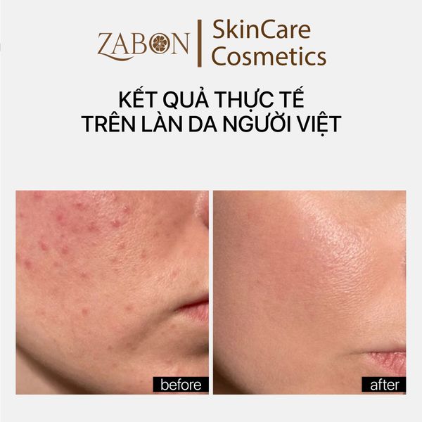 Kem dưỡng TRANSPARENT LAB NIACINAMIDE GLOW CREAM dưỡng sáng da 50ml