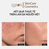 Kem dưỡng TRANSPARENT LAB NIACINAMIDE GLOW CREAM dưỡng sáng da 50ml
